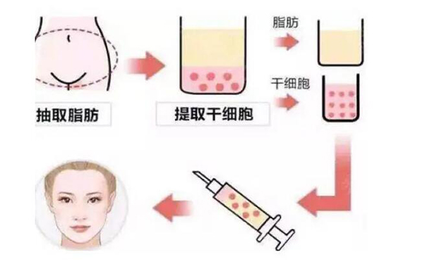 盘锦注射美容