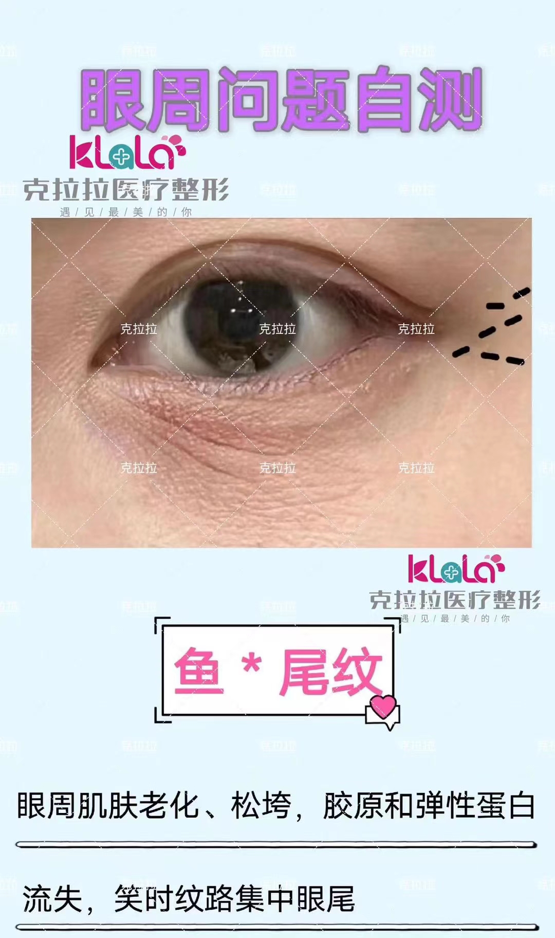 盘锦打眼周营养.jpg